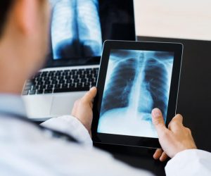Digital-X-Rays-Available-at-Independent-Imaging-in-Wellington